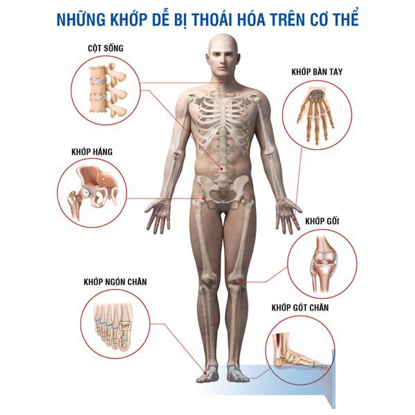 Một số bài tập yoga dành cho người đau thần kinh tọa nên biết