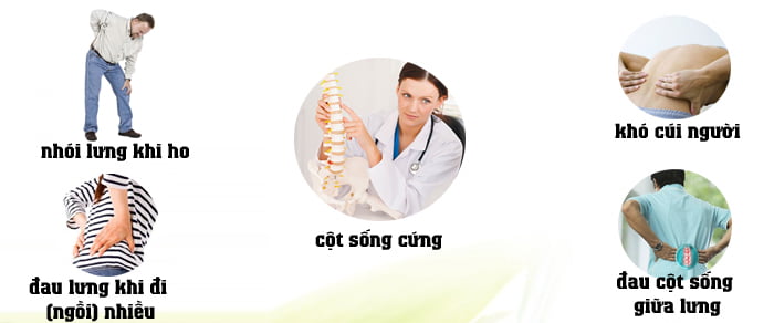 dấu hiệu đau thần kinh tọa
