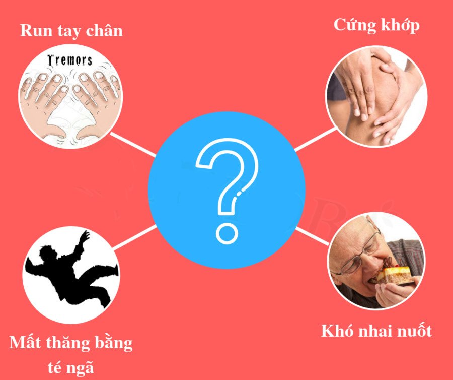 dấu hiệu Parkinson