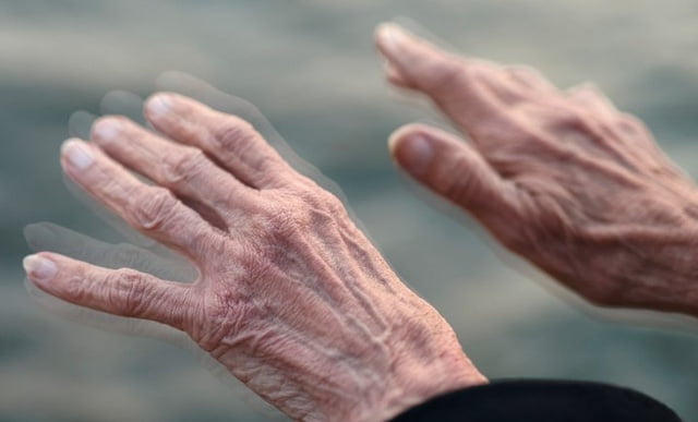 Giải pháp giúp đẩy lui bệnh Parkinson hiệu quả từ thảo dược dành cho người cao tuổi