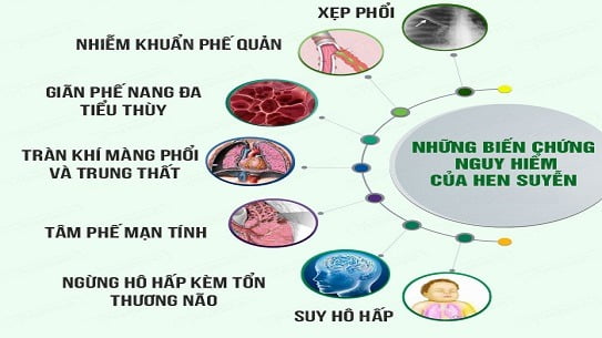 Thuốc chữa hen suyễn hiệu quả