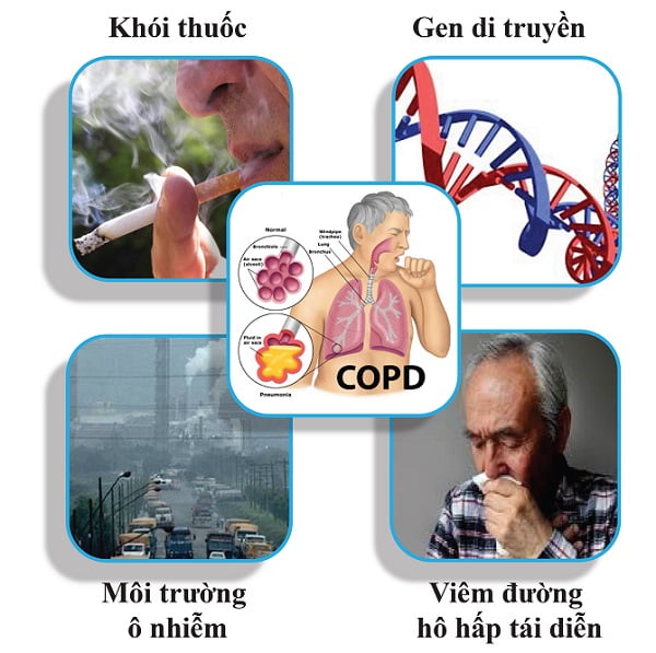 Phân biệt bệnh hen suyễn và phổi tắc nghẽn mãn tính COPD