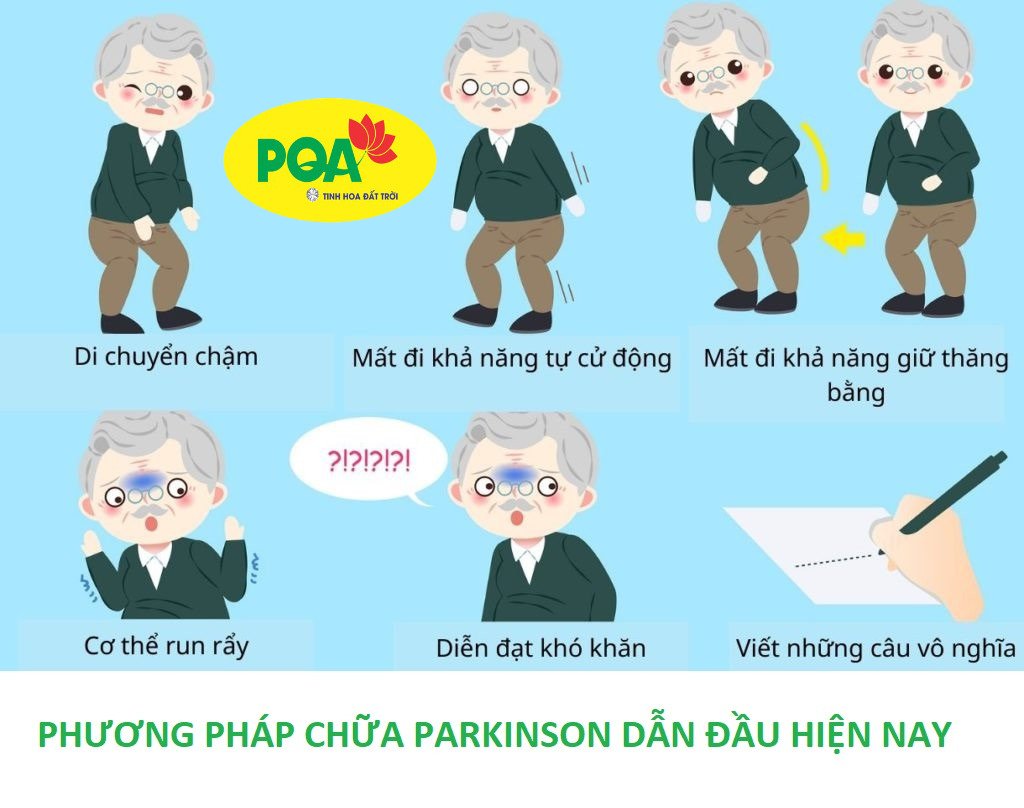 Phương pháp điều trị bệnh Parkinson dẫn đầu hiện nay